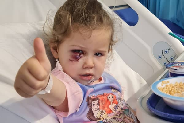Doncaster toddler Elouise Smith recovering in hospital after she was attacked by a dog in December 2023. 